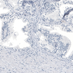 HO-1 Antibody in Immunohistochemistry (Paraffin) (IHC (P))