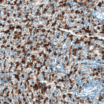 HO-1 Antibody in Immunohistochemistry (Paraffin) (IHC (P))