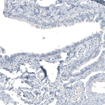 HO-1 Antibody in Immunohistochemistry (Paraffin) (IHC (P))