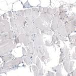 HO-1 Antibody in Immunohistochemistry (Paraffin) (IHC (P))