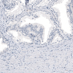 HO-1 Antibody in Immunohistochemistry (Paraffin) (IHC (P))
