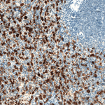 HO-1 Antibody in Immunohistochemistry (Paraffin) (IHC (P))