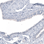 HO-1 Antibody in Immunohistochemistry (Paraffin) (IHC (P))