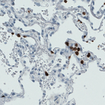 MMP9 Antibody in Immunohistochemistry (Paraffin) (IHC (P))