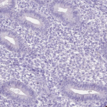 MMP9 Antibody in Immunohistochemistry (Paraffin) (IHC (P))