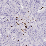 MMP9 Antibody in Immunohistochemistry (Paraffin) (IHC (P))