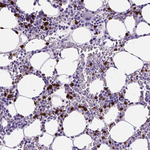 MMP9 Antibody in Immunohistochemistry (Paraffin) (IHC (P))