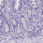 MMP9 Antibody in Immunohistochemistry (Paraffin) (IHC (P))