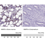 MMP9 Antibody in Immunohistochemistry (Paraffin) (IHC (P))