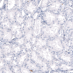 S100A9 Antibody in Immunohistochemistry (Paraffin) (IHC (P))