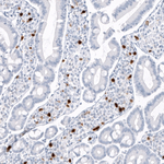 S100A9 Antibody in Immunohistochemistry (Paraffin) (IHC (P))