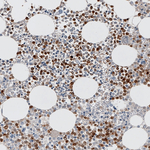 S100A9 Antibody in Immunohistochemistry (Paraffin) (IHC (P))