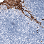 S100A9 Antibody in Immunohistochemistry (Paraffin) (IHC (P))