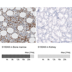 S100A9 Monoclonal Antibody (CL11191)