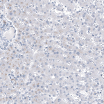 MUC1 Antibody in Immunohistochemistry (Paraffin) (IHC (P))