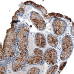 MUC1 Antibody in Immunohistochemistry (Paraffin) (IHC (P))