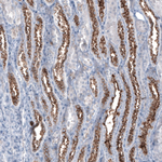 MUC1 Antibody in Immunohistochemistry (Paraffin) (IHC (P))