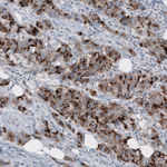 MUC1 Antibody in Immunohistochemistry (Paraffin) (IHC (P))