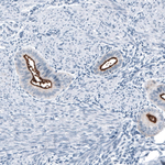MUC1 Antibody in Immunohistochemistry (Paraffin) (IHC (P))