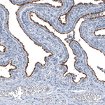 MUC1 Antibody in Immunohistochemistry (Paraffin) (IHC (P))