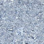 STAT3 Antibody in Immunohistochemistry (Paraffin) (IHC (P))