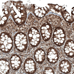 STAT3 Antibody in Immunohistochemistry (Paraffin) (IHC (P))