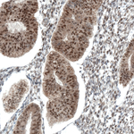 STAT3 Antibody in Immunohistochemistry (Paraffin) (IHC (P))