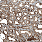 STAT3 Antibody in Immunohistochemistry (Paraffin) (IHC (P))