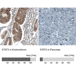 STAT3 Antibody in Immunohistochemistry (Paraffin) (IHC (P))