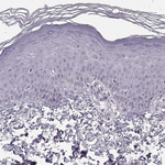 N-cadherin Antibody in Immunohistochemistry (Paraffin) (IHC (P))