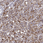 N-cadherin Antibody in Immunohistochemistry (Paraffin) (IHC (P))