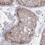 N-cadherin Antibody in Immunohistochemistry (Paraffin) (IHC (P))