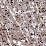 N-cadherin Antibody in Immunohistochemistry (Paraffin) (IHC (P))