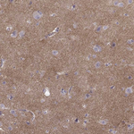 N-cadherin Antibody in Immunohistochemistry (Paraffin) (IHC (P))