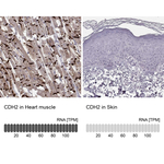 N-cadherin Antibody in Immunohistochemistry (Paraffin) (IHC (P))