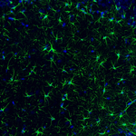 GFAP Antibody in Immunohistochemistry (Paraffin) (IHC (P))