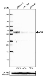 GFAP Antibody in Western Blot (WB)