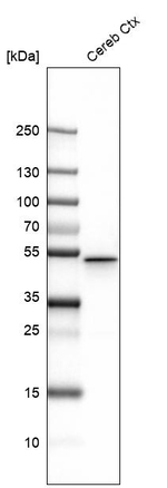 GFAP Antibody in Western Blot (WB)
