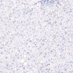 SOX2 Antibody in Immunohistochemistry (Paraffin) (IHC (P))