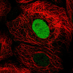 PARP1 Antibody in Immunocytochemistry (ICC/IF)