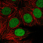 PARP1 Monoclonal Antibody (CL2220)