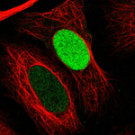 PARP1 Antibody in Immunocytochemistry (ICC/IF)