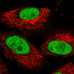 PARP1 Antibody in Immunocytochemistry (ICC/IF)