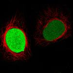 PARP1 Antibody in Immunocytochemistry (ICC/IF)