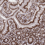 PARP1 Antibody in Immunohistochemistry (Paraffin) (IHC (P))