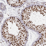 PARP1 Antibody in Immunohistochemistry (Paraffin) (IHC (P))