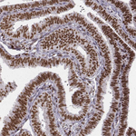 PARP1 Antibody in Immunohistochemistry (Paraffin) (IHC (P))