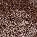 PARP1 Antibody in Immunohistochemistry (Paraffin) (IHC (P))