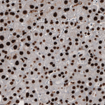 PARP1 Antibody in Immunohistochemistry (Paraffin) (IHC (P))
