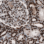 PARP1 Antibody in Immunohistochemistry (Paraffin) (IHC (P))